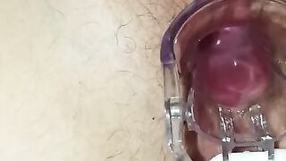 I look into my wifes pussy with spekulum big klit