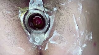 Hot Anal gaping & tunnel plug. Hairy cunt & asshole close-up