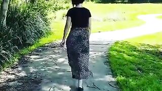 amputee