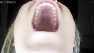 Yawning Roof Mouth