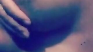 Lactating breast